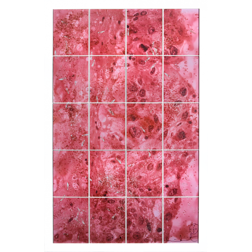 Damien Hirst – a complete ‘Biopsy Painting’ reproduction